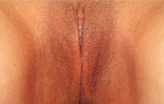 Prepubesent girl pussy 